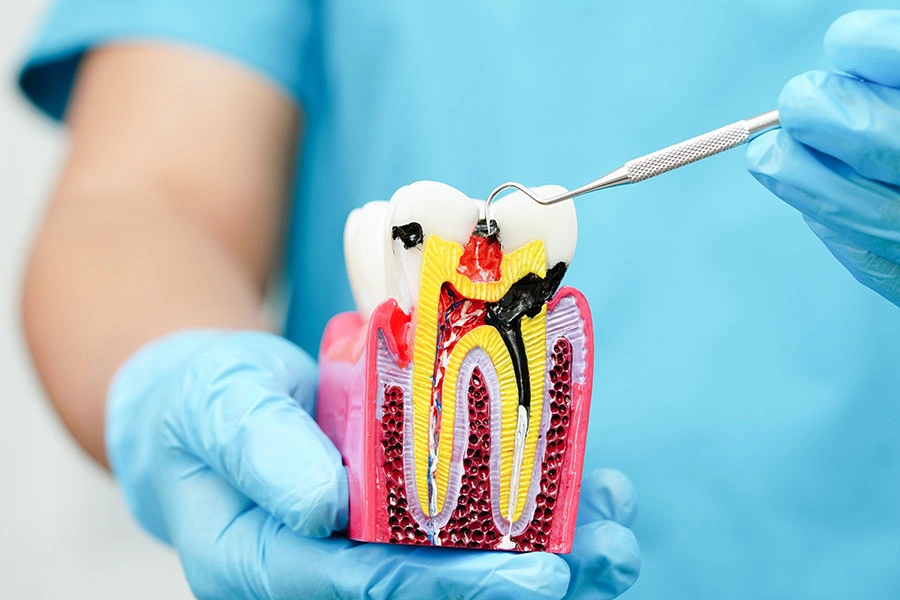 The Importance of Nutrition for Dental Health